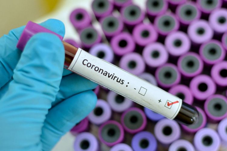 ÜST koronavirusla mübarizə üçün İrana tibbi yardım və altı tibbi heyət göndərib