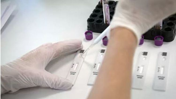 ÜST: Hazırda 17 koronavirus peyvəndi klinik sınaq məshələsindədir