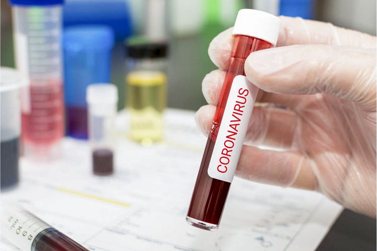Dünyada koronavirusa yoluxanların sayı 31 milyonu ötüb