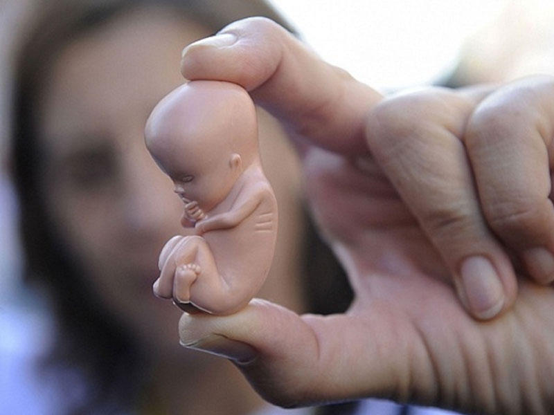 Azərbaycan aborta görə dünyada birincidir