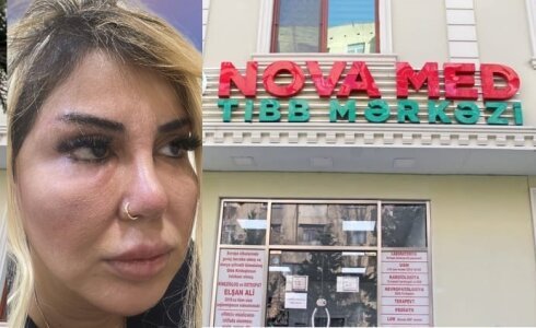 Xəyalə İsmayılova”Nova Med” klinikasında yenidən iş başında: -Video
